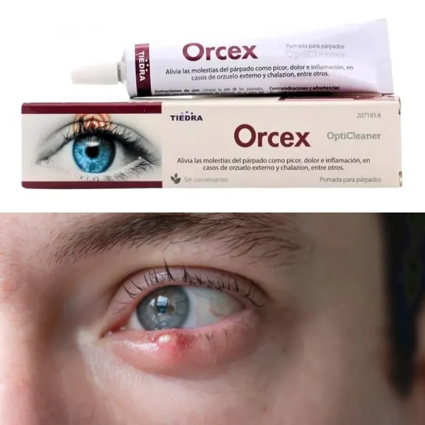 Orcex crema orzuelo 15g cuidado párpados inflamación ocular
